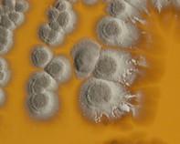 streptomyces colonies streptomyces colonies